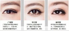 寧波做雙眼皮手術(shù)后眼睛腫脹怎么辦？