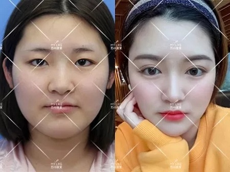 雙眼皮真的可以讓一部分人擁有神仙顏值！