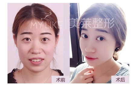 美萊特邀整形醫(yī)師—卜勝利主任，