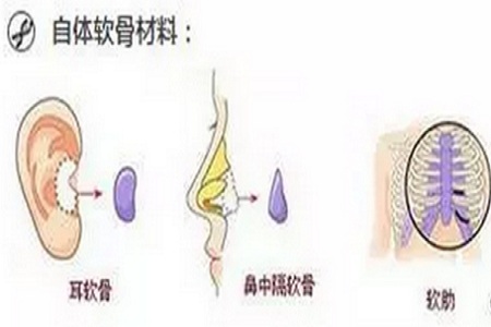 哪些人適合半肋，哪些人適合全肋？