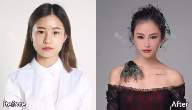 為什么打了瘦臉針，醫(yī)師還要我再打玻尿酸？