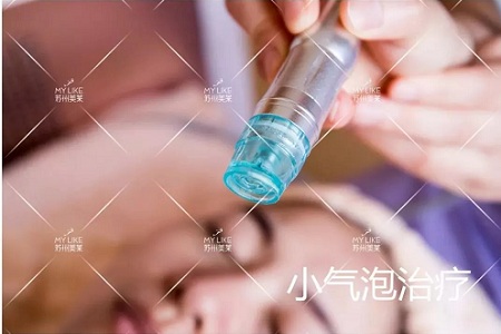 你知道臉上的黑頭和白頭是怎么形成的嗎？