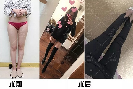 顏值：金剛?cè)绾位黹L腿女神？