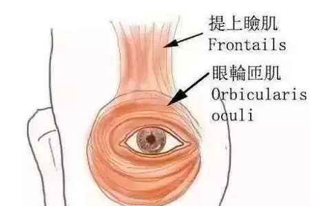 做了雙眼皮，醫(yī)師為什么建議要多睜眼？