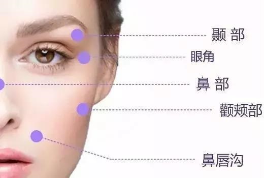 逆齡美學注射玻尿酸，瞬間get你想要的美!