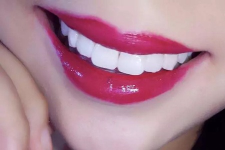 泉州做牙齒冷光美白多少錢(qián)