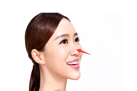 福州假體隆鼻要多少錢(qián)