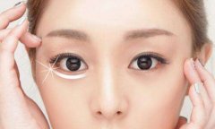 深圳美萊祛除眼袋的更好辦法是什么？