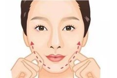 廣州整形醫(yī)院面部吸脂瘦臉有效嗎，會不會反彈呢