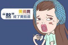 激光真的能去黃褐斑嗎，祛斑價格是多少